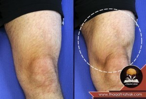 تمارين الركبة لتقويتها وعلاج أوجاعها تمارين الركبة لتقويتها وعلاج أوجاعها