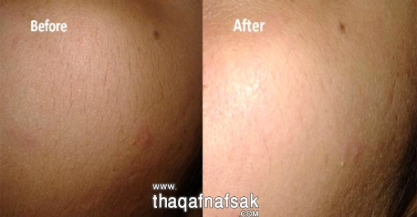 تشقير شعر الوجه بالطماطم والدقيق