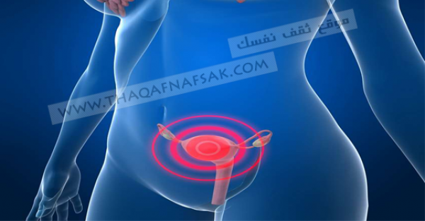 تعرفي على ألم المبيضين أسبابه وطرق علاجه تعرفي على ألم المبيضين أسبابه وطرق علاجه