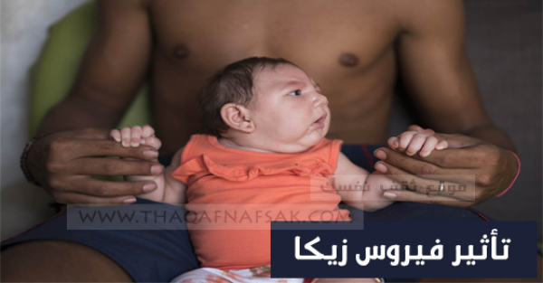 دليلك الشامل للتعرف علي فيروس زيكا دليلك الشامل للتعرف علي فيروس زيكا