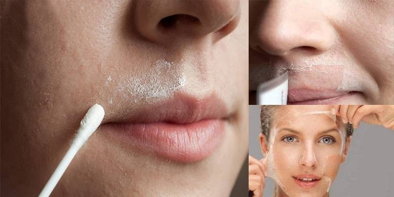 التخلص من شعر الوجه نهائي بوصفات طبيعية التخلص من شعر الوجه نهائي بوصفات طبيعية