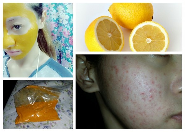 علاج اثار حب الشباب بهذا الماسك بالصور
