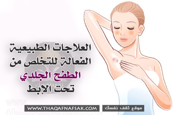 العلاجات الطبيعية الفعالة للتخلص من الطفح الجلدي تحت الإبط