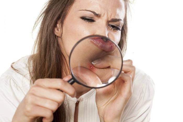 علاج البثور بـ ١٥ طريقة فعاله علاج البثور بـ ١٥ طريقة فعاله