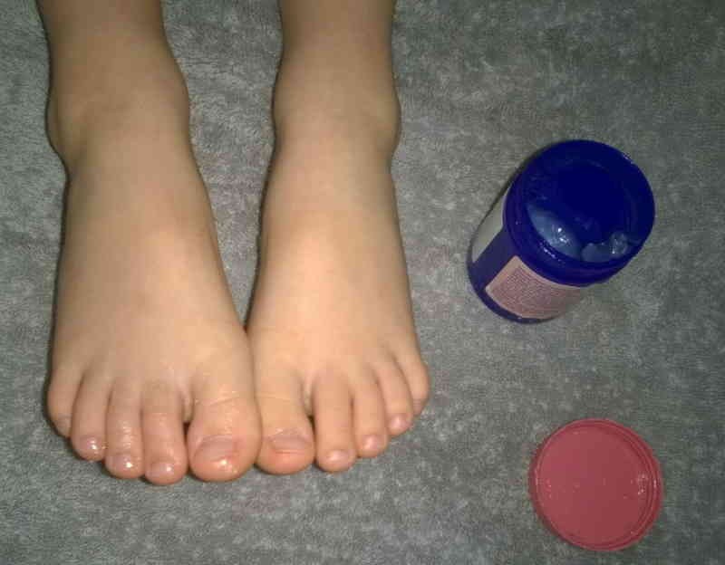 علاج البرد بتدليك القدمين بكريم أبوفاس