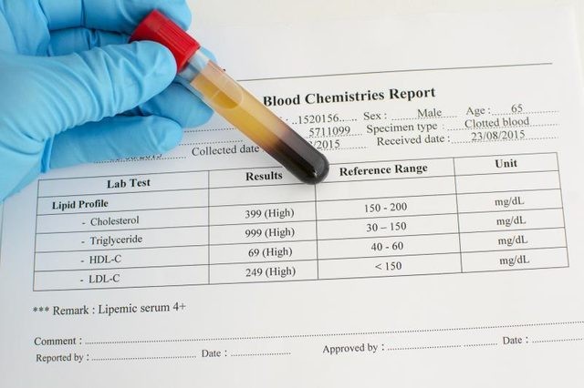 كيفية قراءة تحليل الكوليسترول في الدم ؟