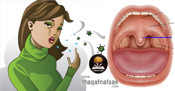 علاجات إلتهاب الحلق وبحة الصوت 16 طريقة فعالة