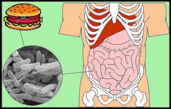 التسمم أنواعه ومخاطرة وطرق الوقاية منه