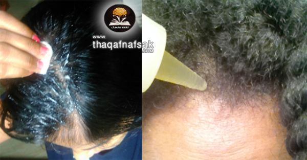 تنعيم الشعر الخشن ٢٠ وصفة منزلية بسيطة