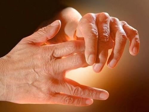 أسباب وعلاج تنميل اليدين والقدمين أسباب وعلاج تنميل اليدين والقدمين