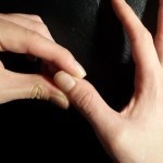 علاج فوري وسريع: تدليك اليد والأصابع لتخفيف الألم بالصور