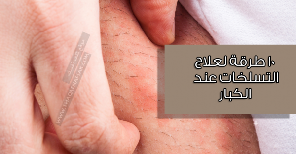 علاج التسلخات عند الكبار بـ ١٠ طرق علاج التسلخات عند الكبار بـ ١٠ طرق