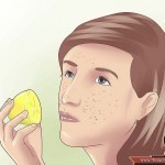 بالصور علاج البقع البنية في الجسم والوجه