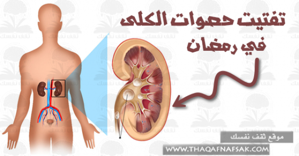 تفتيت حصوات الكلي في رمضان و تخفيف أوجاعها ١٧ طريقة تفتيت حصوات الكلي في رمضان و تخفيف أوجاعها ١٧ طريقة