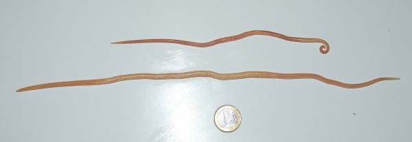 ديدان الأسكارس أسباب الإصابه بها وطرق علاجها والوقايه منها