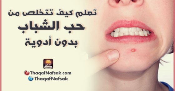 كيف تتخلص من حب الشباب بدون استخدام أدوية ؟