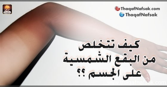 كيف تتخلص من البقع الشمسية على الجسم ؟ كيف تتخلص من البقع الشمسية على الجسم ؟
