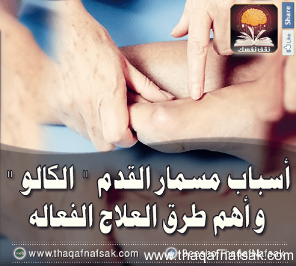 أسباب و علاج مسمار القدم “الكالو” أسباب و علاج مسمار القدم “الكالو”