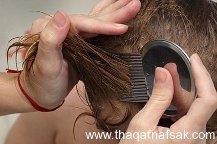 القمل والصيبان الأعراض وكيفية القضاء عليها القمل والصيبان الأعراض وكيفية القضاء عليها