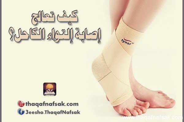 كيف تعالج إصابة إلتواء مفصل القدم ( الكاحل ) ؟ كيف تعالج إصابة إلتواء مفصل القدم ( الكاحل ) ؟