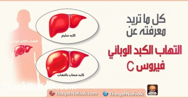 دراسة كاملة عن مرض فيروس سي الكبدي دراسة كاملة عن مرض فيروس سي الكبدي