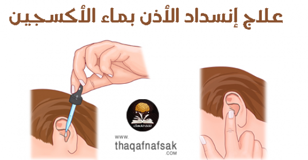 علاج انسداد الأذن بسبب الشمع بماء الاكسجين علاج انسداد الأذن بسبب الشمع بماء الاكسجين