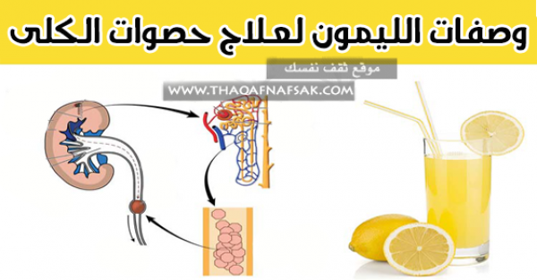 علاج حصى الكلى بوصفات الليمون علاج حصى الكلى بوصفات الليمون