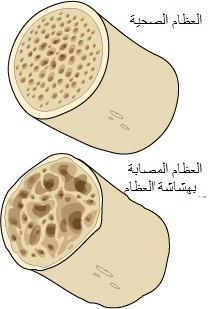نصائح لعظام أقوى نصائح لعظام أقوى