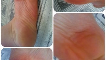 طريقة تجهيز ماسك تقشير القدم الكوري