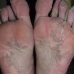 طريقة تجهيز ماسك تقشير القدم الكوري