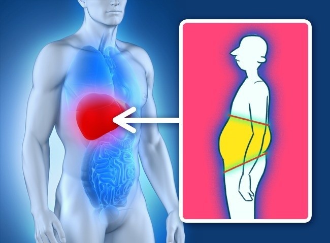 أسباب زيادة الوزن بعيداً عن النظام الغذائي أسباب زيادة الوزن بعيداً عن النظام الغذائي