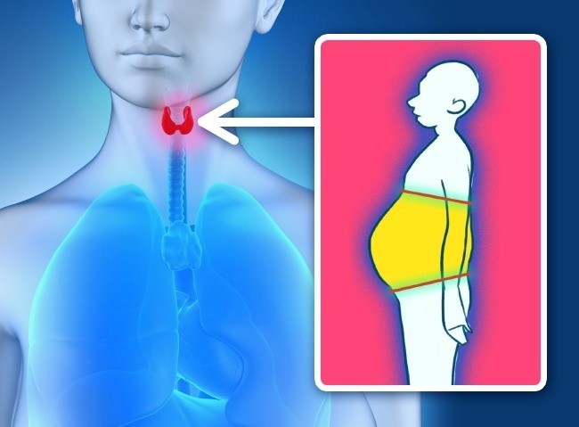 أسباب زيادة الوزن بعيداً عن النظام الغذائي أسباب زيادة الوزن بعيداً عن النظام الغذائي