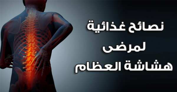 10 نصائح غذائية لمرضى هشاشة العظام 10 نصائح غذائية لمرضى هشاشة العظام