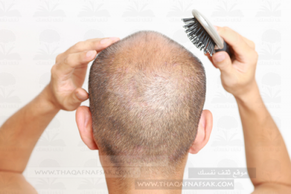 أهم 10 خطوات لزيادة كثافة الشعر للرجال أهم 10 خطوات لزيادة كثافة الشعر للرجال