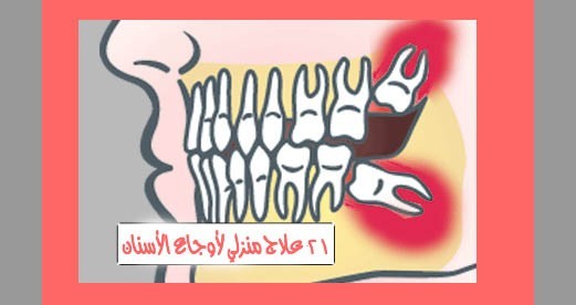 ٢١ طريقة مثالية مفيدة في علاج آلام الأسنان