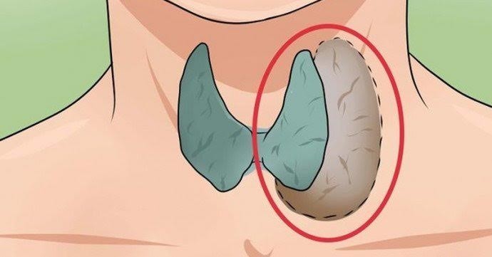 علامات خمول الغدة الدرقية وطرق علاجها علامات خمول الغدة الدرقية وطرق علاجها