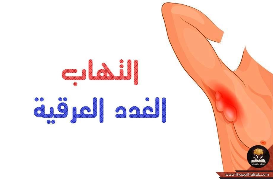 التهاب الغدد العرقية اسبابها ومخاطرها وطرق علاجها والتعامل معها التهاب الغدد العرقية اسبابها ومخاطرها وطرق علاجها والتعامل معها