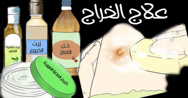 بالصور خطوات علاج الخراج في البيت بطرق طبيعية في زمن قياسي