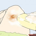 بالصور خطوات علاج الخراج في البيت بطرق طبيعية في زمن قياسي