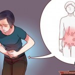 كيف أعرف إني مصاب بالزائدة ؟ هذه هي أعراض التهاب الزائدة الدودية