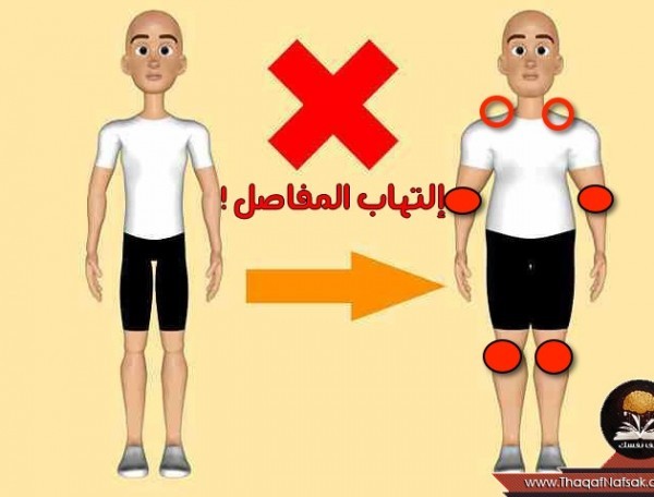 بالصور أهم الطرق التي تساعدك في علاج إلتهاب المفاصل بالصور أهم الطرق التي تساعدك في علاج إلتهاب المفاصل