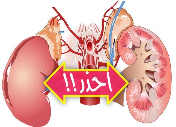 ١٠ عادات تدمر الكلى أحذر منها لتحافظ على صحة الكليتين ١٠ عادات تدمر الكلى أحذر منها لتحافظ على صحة الكليتين