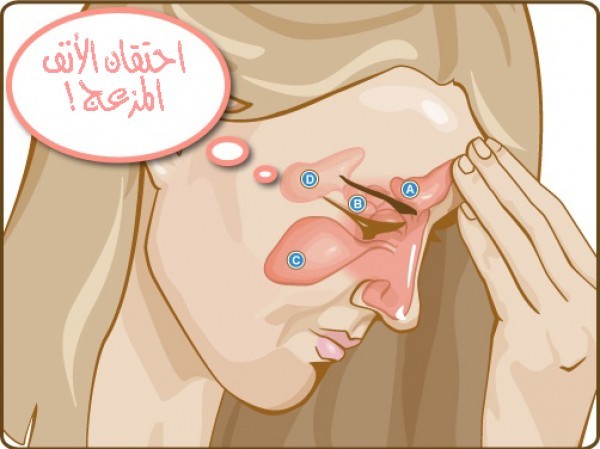 ١٠ علاجات طبيعيه لاحتقان الانف في المنزل