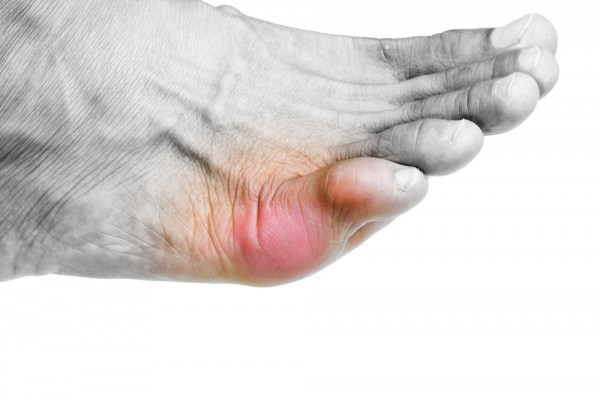 علاج تورم الاصابع أصبح أسهل مع ١٠ وصفات منزلية فعالة