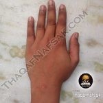 علاج الحبوب في شهر واحد احصلي على وجه لامع خالي من حب الشباب وآثاره علاج الحبوب في شهر واحد احصلي على وجه لامع خالي من حب الشباب وآثاره