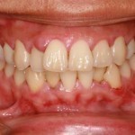 بالصور ماذا تقول ملامح وجهك عن صحتك ؟