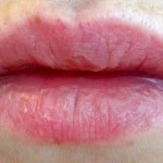 بالصور ماذا تقول ملامح وجهك عن صحتك ؟