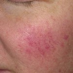 بالصور ماذا تقول ملامح وجهك عن صحتك ؟