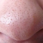 بالصور ماذا تقول ملامح وجهك عن صحتك ؟