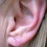 بالصور ماذا تقول ملامح وجهك عن صحتك ؟